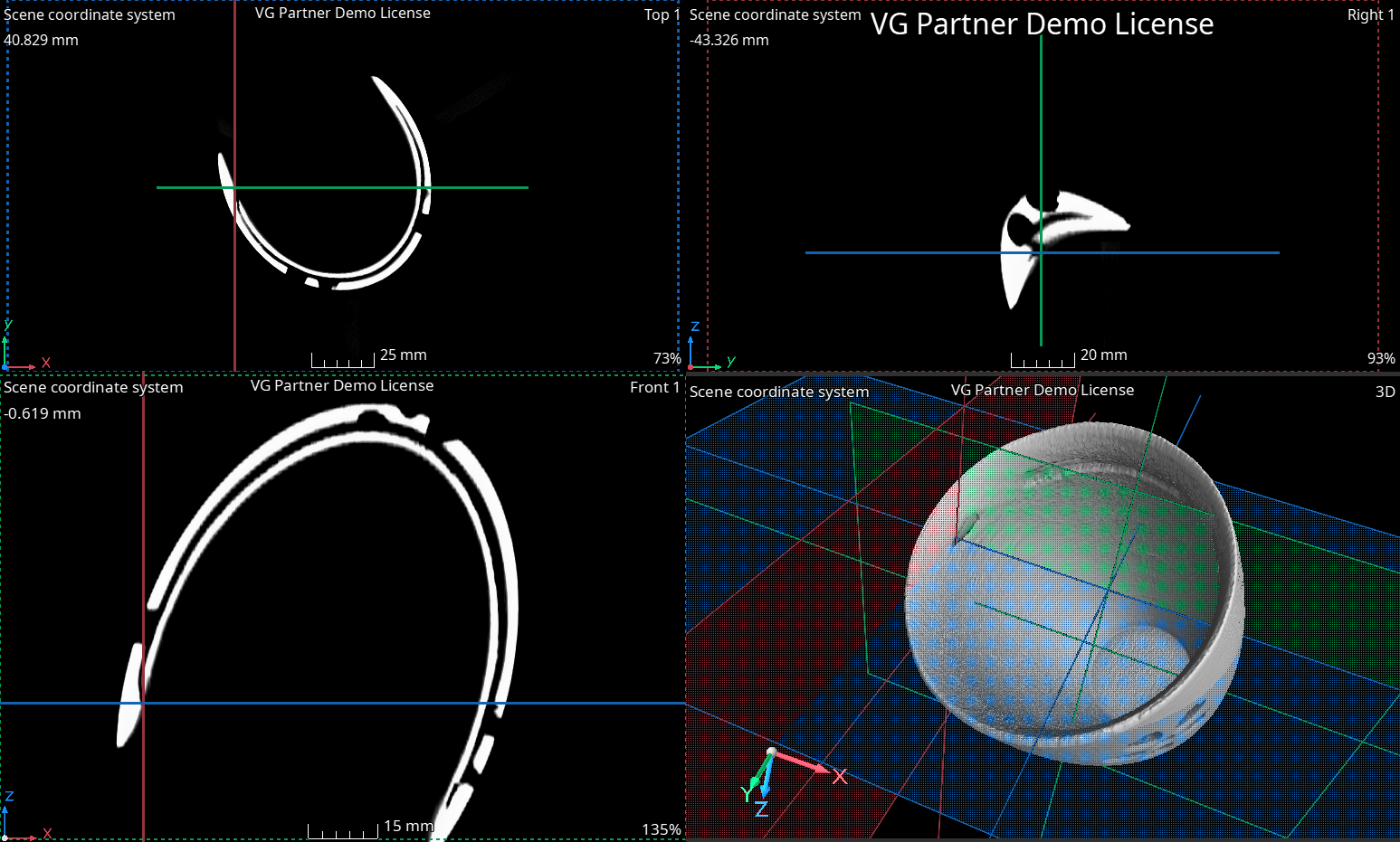 Sample CT Scan, Cup Half Empty