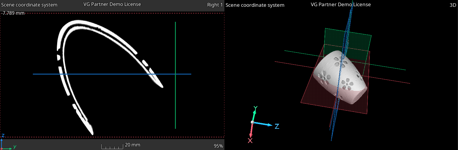 Sample CT Scan, Cup Half Full